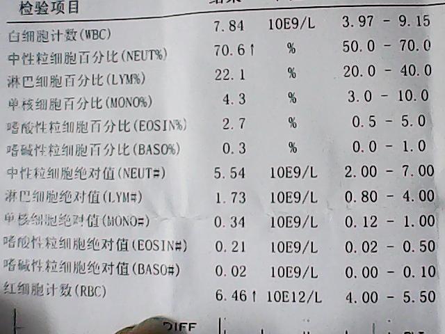 请医生帮我看一下血常规化验单;我是否是地中海贫血