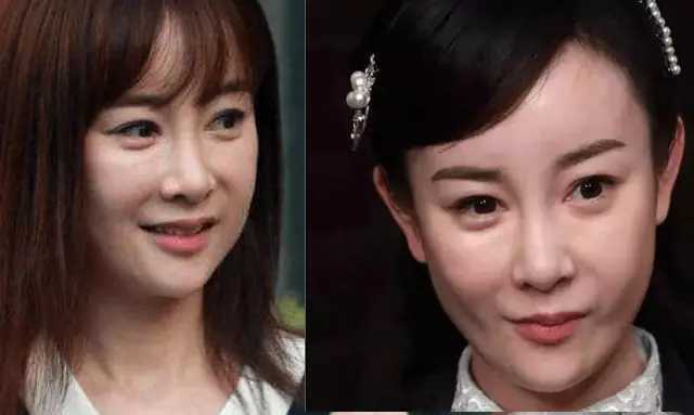 脸愣被她变成毫无辨识度的网红女,实在是众多女明星当中整容最失败的