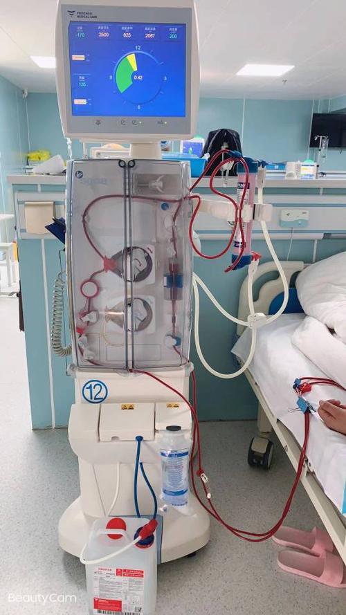 费森5008血滤机,血滤器fx800,高品质透析液产生高质量的透析效果,迎接