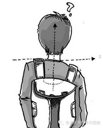第二步 用手摸一摸孩子背部的肩胛骨,看两块肩胛骨最下端是否等高,有