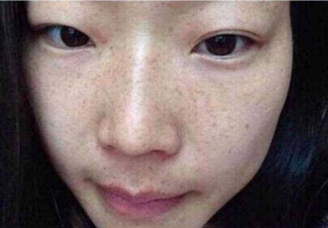 建议女人:脸上长了斑点不要慌,坚持做这一件事,斑点