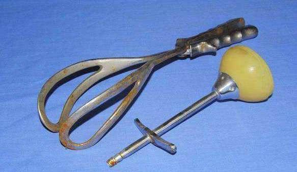 产钳是什么 杭州社保产钳