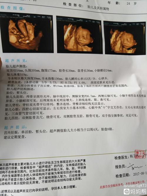 四维彩超顺利通过