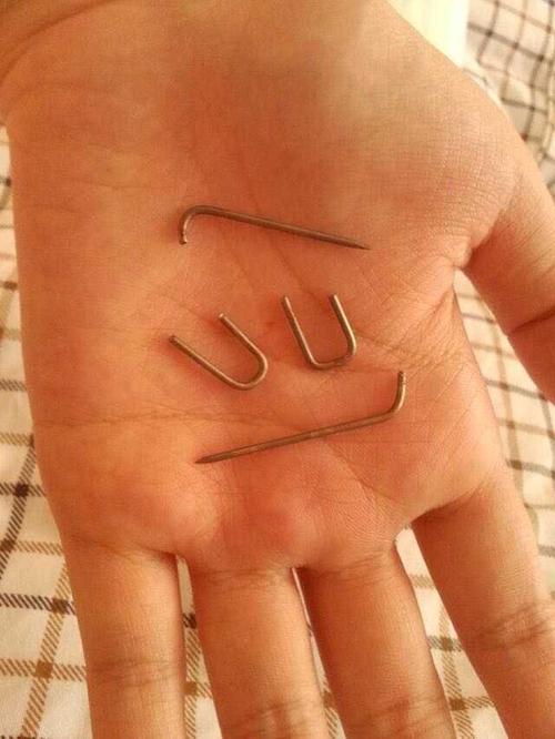 感觉并不会,去年做一个矫正性手术在脚里打了克氏针,的确很贵,没记错