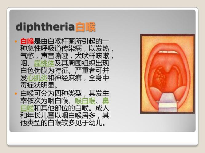 严重者可并 发心肌炎和神经麻痹,全身中 毒症状明显.