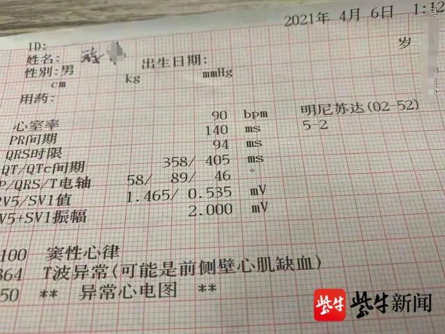 网上晒出的部分游伟心电图检查报告