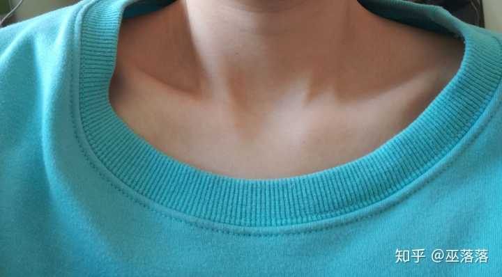 人的锁骨形状分类有几种?