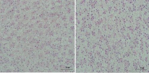 罗非鱼肝细胞核偏位,细胞内存在大量脂肪滴