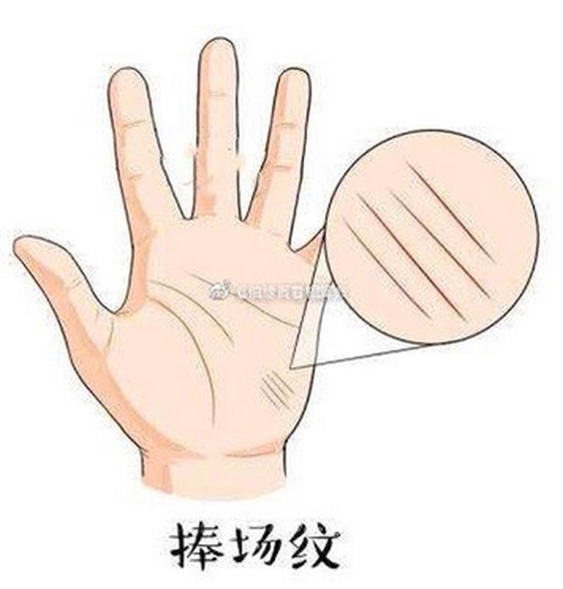 你们手中有没有捧场纹,并不是我们面部的捧场纹.