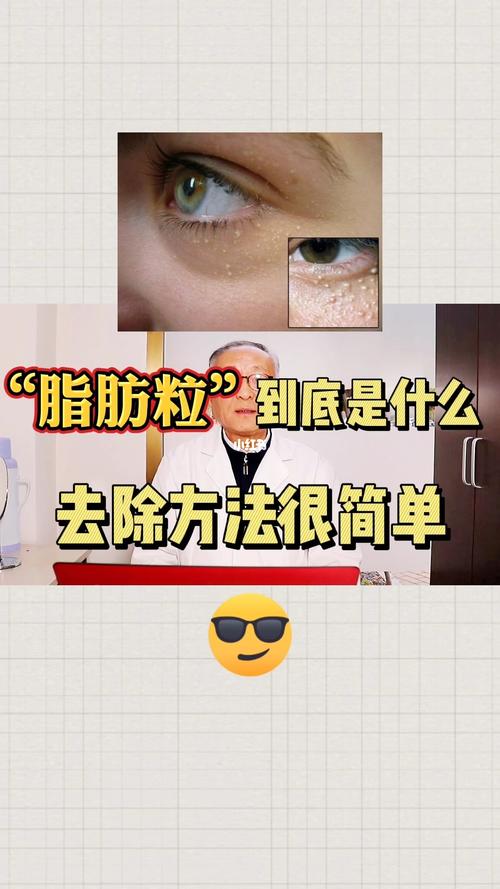 "脂肪粒"的真实身份75_脂肪粒_北京自由行热门攻略