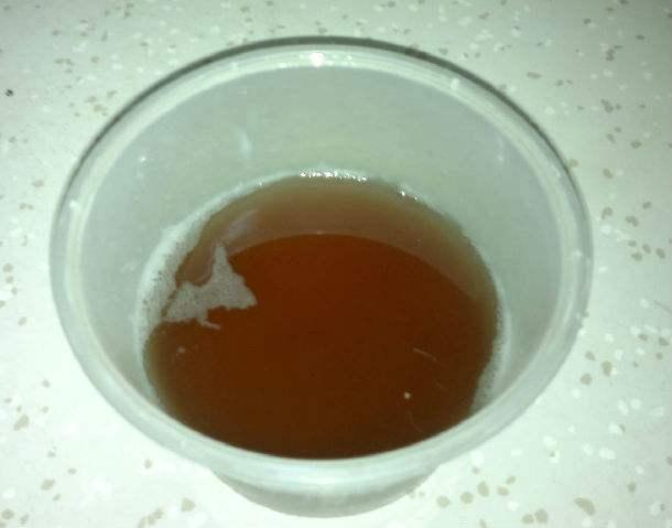 晨起时,第一泡尿,若没有以下3个现象,恭喜,你的肾脏很健康