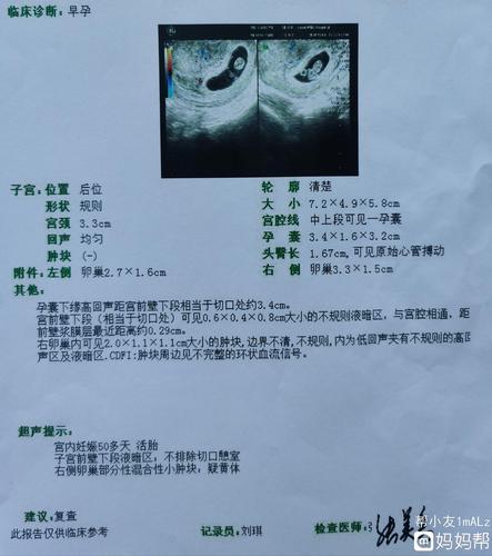 麻烦帮忙看下是男孩还是女孩?都说看孕囊像