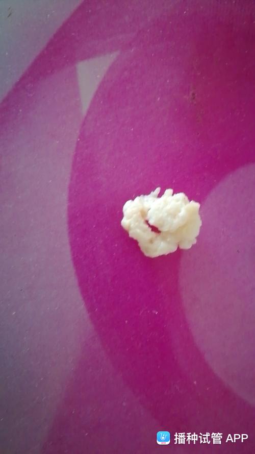 [试管婴儿]亲们,黄体酮凝胶药渣残留是这样