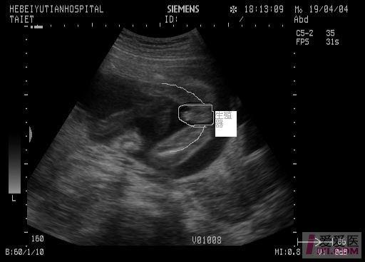 【分享】胎儿b超(dxy)