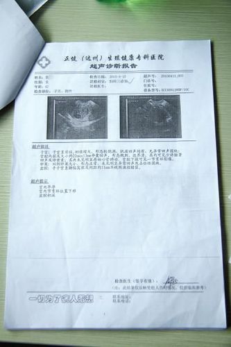 黄女士在正健医院做的超声诊断报告