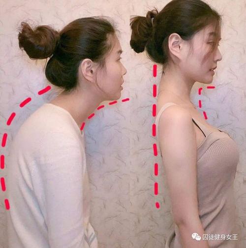 还在圆肩驼背学会这几个动作助你重拾挺拔身姿