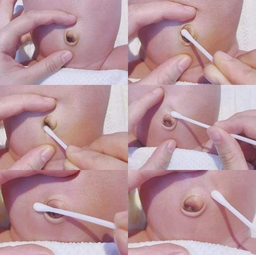 新生儿肚脐护理很讲究,爸妈们一定要知道!