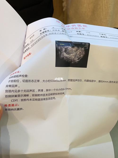 宫颈纳氏囊肿_子宫_月经_子宫内膜薄_医疗健康_医疗