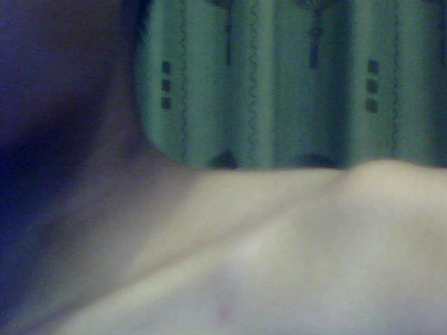 乳头周围起了很多小点点,很突出,是不是怀孕了