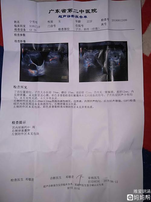 第一次照b超,b超显示右侧卵巢囊肿,有点
