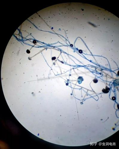 我思故我在:显微镜下的根霉 小编:还怪好看呢!