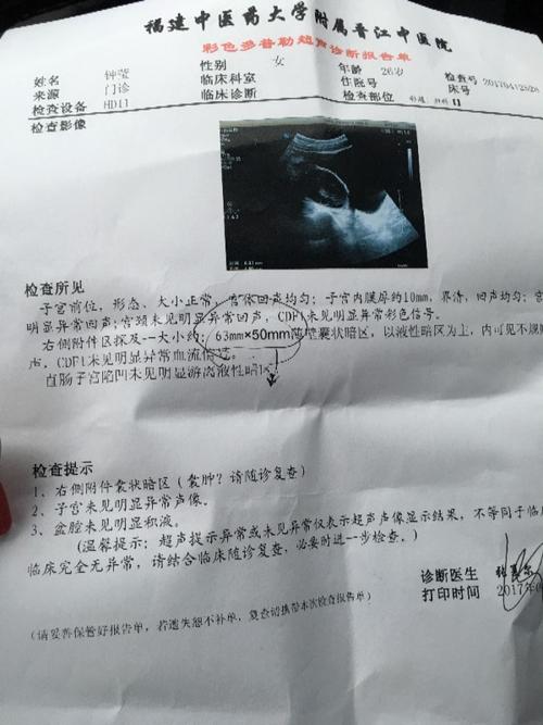 请问右侧附件囊肿,是卵巢囊肿吗?