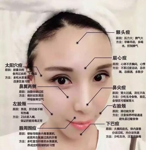 面部长痘位置分析