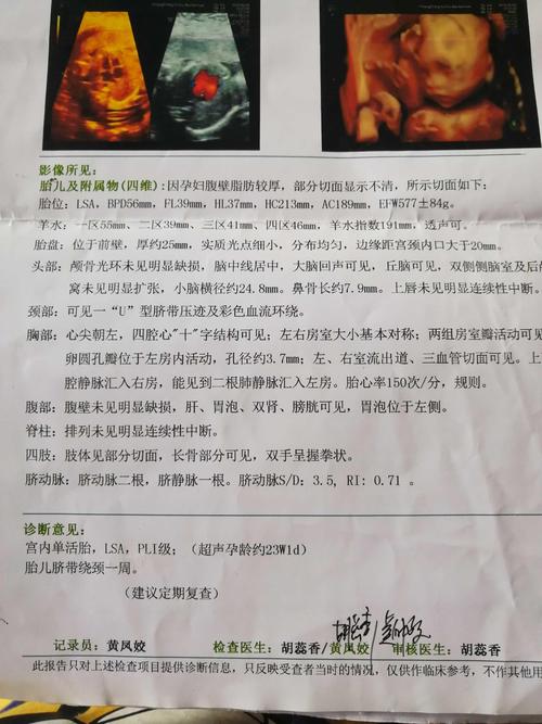 快30周了,现在才发24周的四维彩超,已
