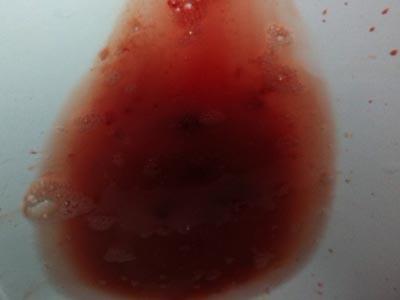 直肠癌便血是什么颜色的呢