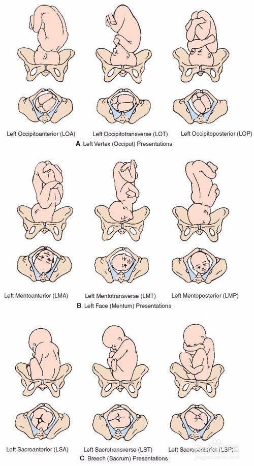 为"枕",即"o", a href="#" data-lemmaid="5244345">臀先露 /a>为"骶"