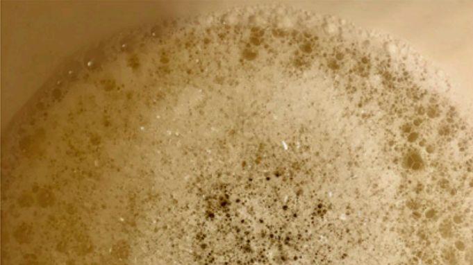 尿中泡沫增多是怎么回事_蛋白