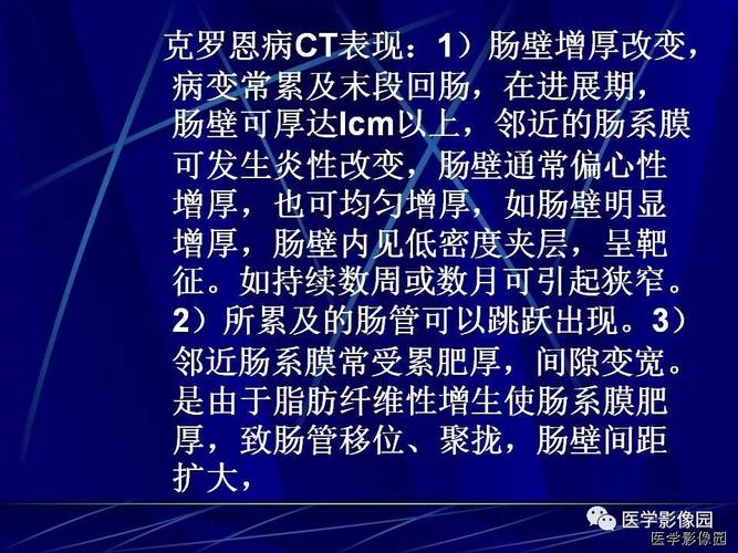 病例克罗恩病crohn病1例ct