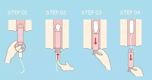 原创40岁女士初次用卫生棉条卡在身体里医生苦笑不得你用错了