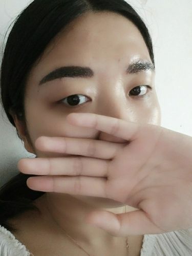 雾眉掉痂前,和掉痂后对比 刚做完照镜子连哭三天 惨不