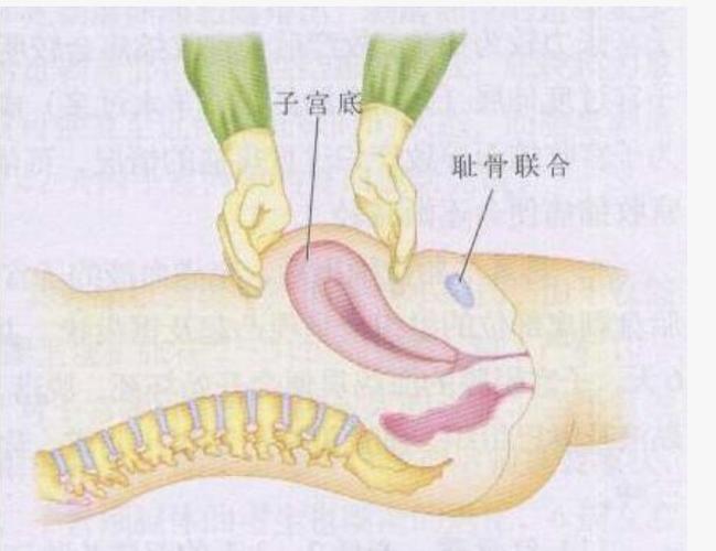 产后按摩子宫的重要性