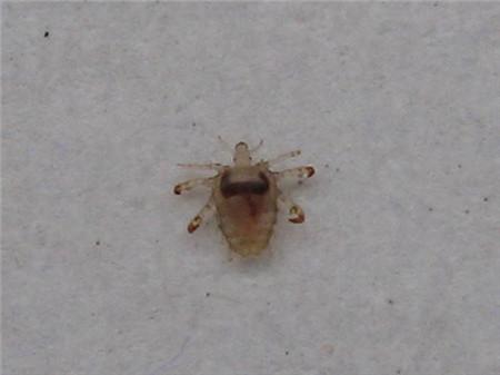 阴虱的潜伏期是多久不知不觉间你可以患上了阴虱