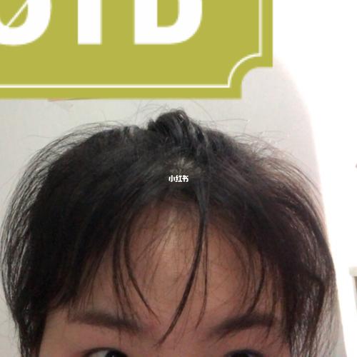 自然卷刘海怎么办_刘海_自然卷_时尚_发型