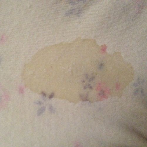 羊水有流一点的吗,我这样是羊水吗