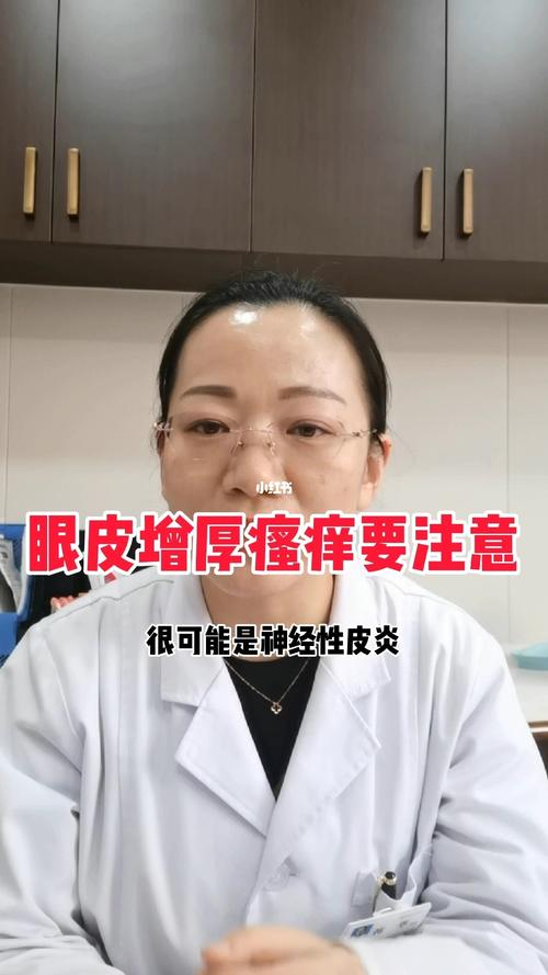 神经性皮炎会长在眼皮上吗?_皮炎_脂溢性皮炎_薯条