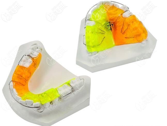 activator的矫正力来源于咀嚼肌,在没戴牙套前,咀嚼肌处于平衡状态