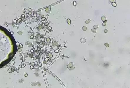 葡萄霜霉病详细剖析及防治方案