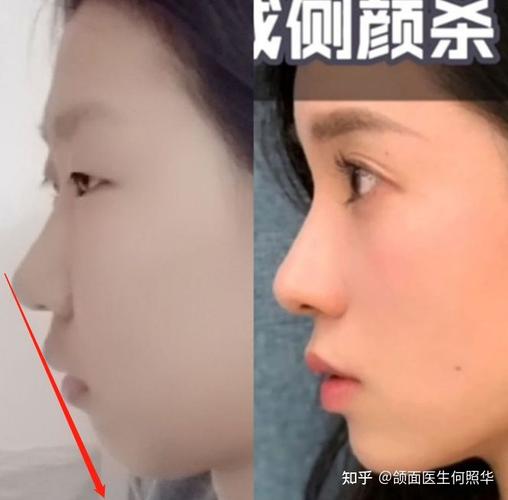 请问我的侧脸为什么显得很奇怪?