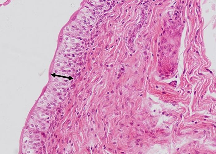 4,图中箭头标识的是一种上皮组织,根据其形态,判断是哪一种类型?