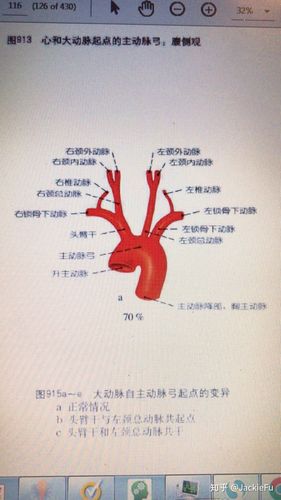 胸主动脉解剖 - 知乎