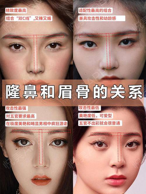 隆鼻和眉骨的关系_悦美整形