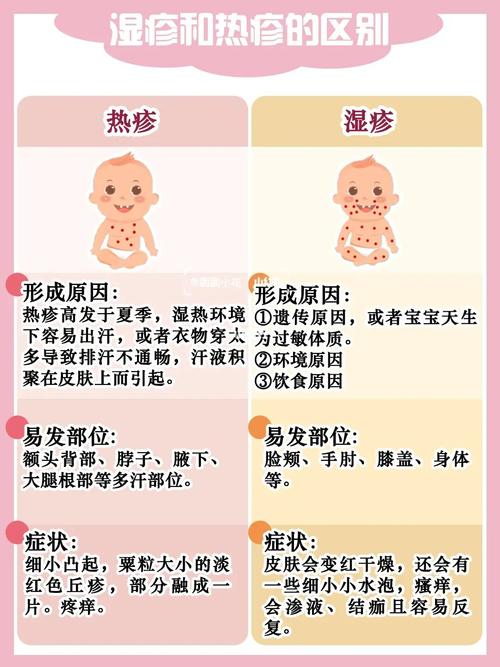 热疹_湿疹