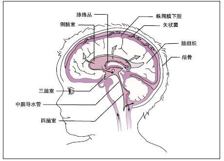 3岁半孩子患病成"大头娃娃",先天性脑积水知多少?