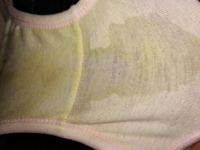 孕39周,晚上睡觉下体总有水流出,不知是漏尿还是羊水早破?请