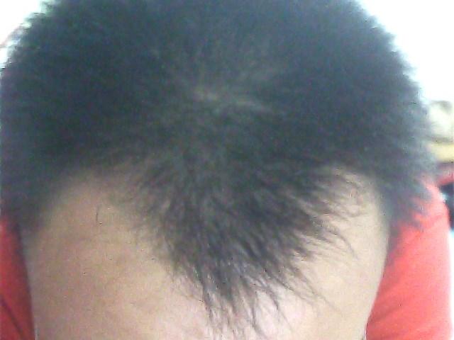 额角没有头发,正面看上去不好看,弄什么发型好,男短发,爱出油