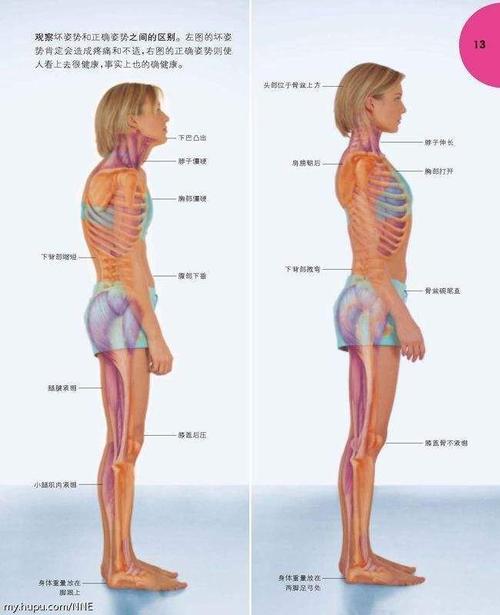 图解腰椎间盘突出症